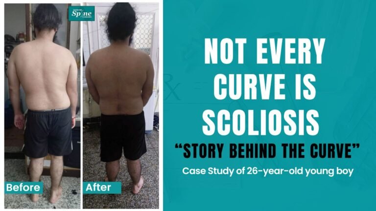 Microdiscectomy (Microdecompression) Spine Surgery - Case Study of 26 ...