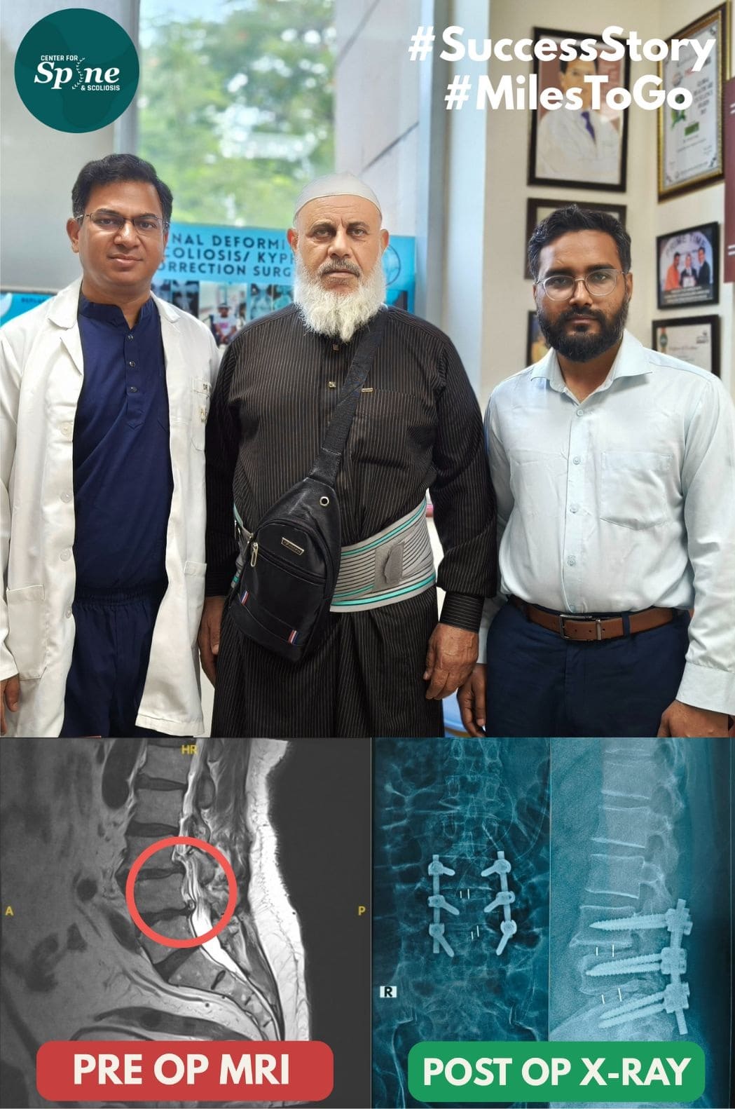 A Successful Spine Surgery: Journey from Iraq to India