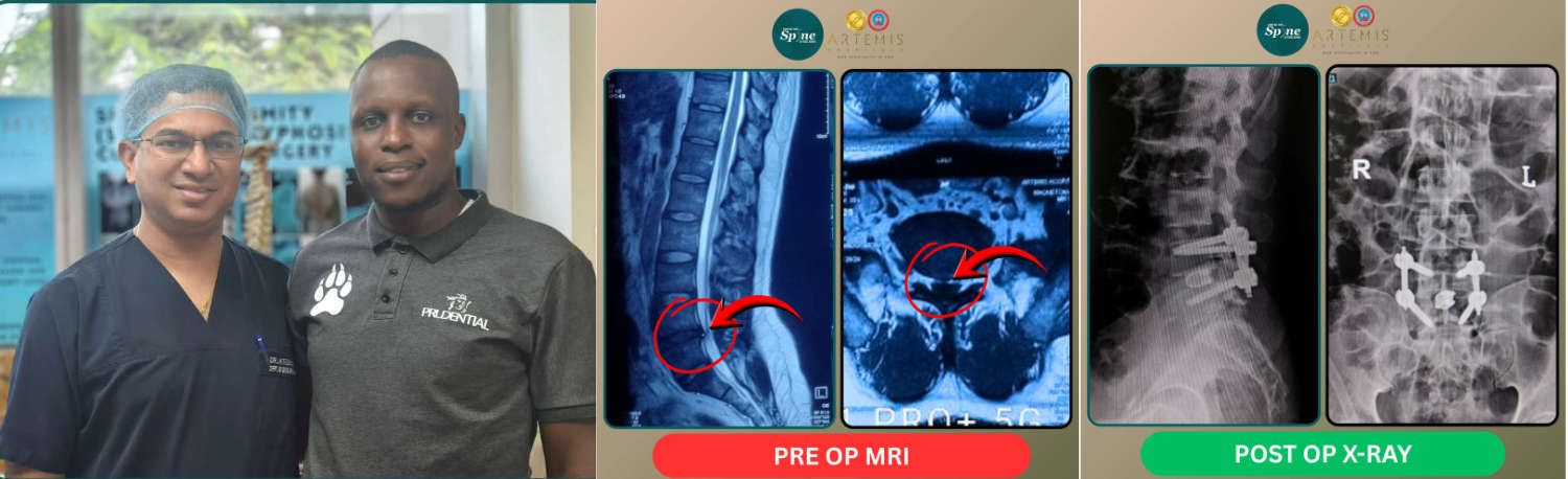 A Ugandan Gentleman’s Journey to Recovery at Artemis Hospital