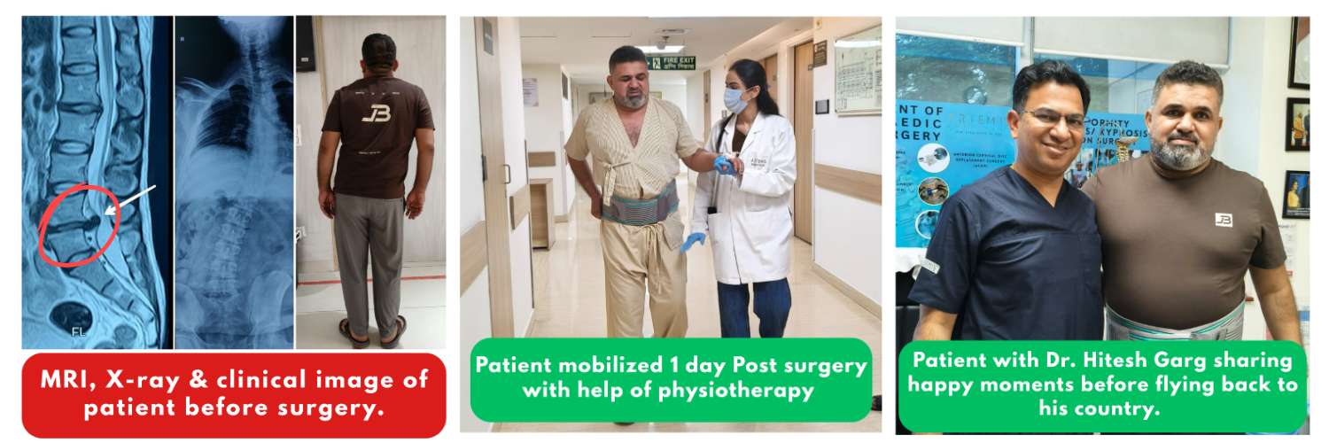 What You Need to Know About the Scoliotic List